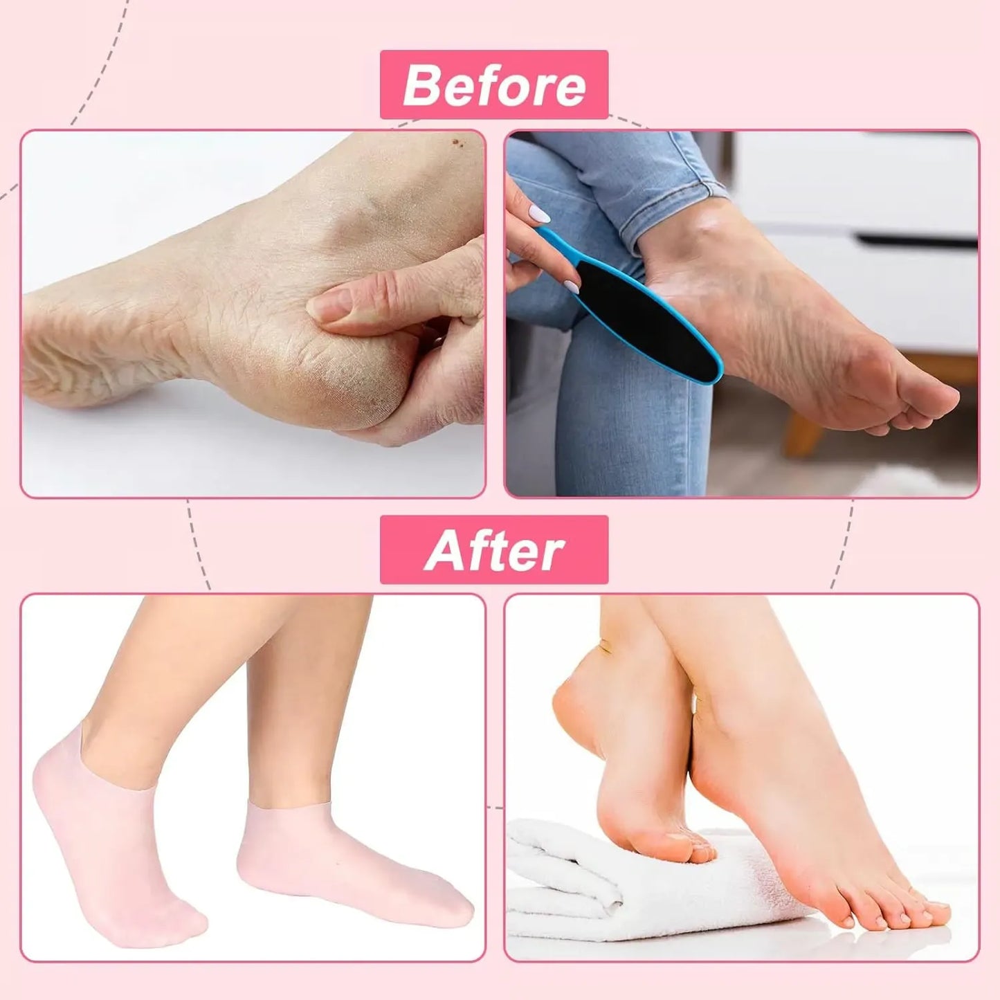 2 IN 1 DEAL  Silicone Heel Protectors + Free Foot Foot Care Moisturizer