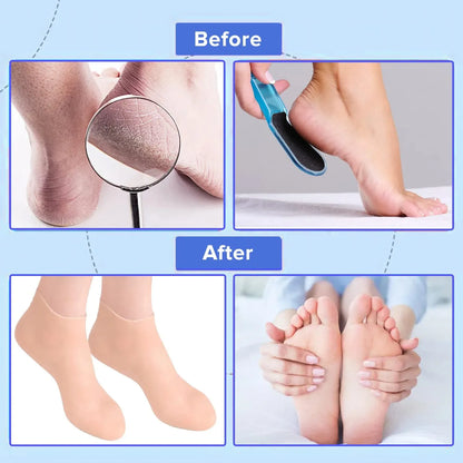 (BUY 1 GET 1 )Silicone Gel Moisturizing Sock Prevent Foot Heel Crack Shoes